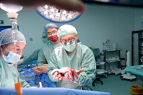doctor transplant