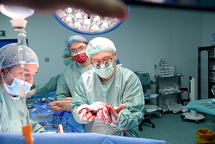 doctor transplant