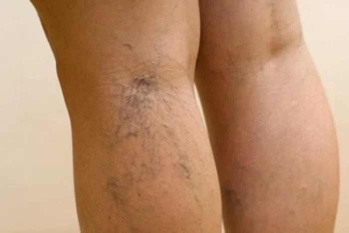 Traista ciobanului e un bun remediu pentru varice. Foto: arhiva.