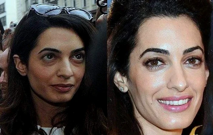 6 amal clooney before and after plastic surgery 6 jpg jpeg