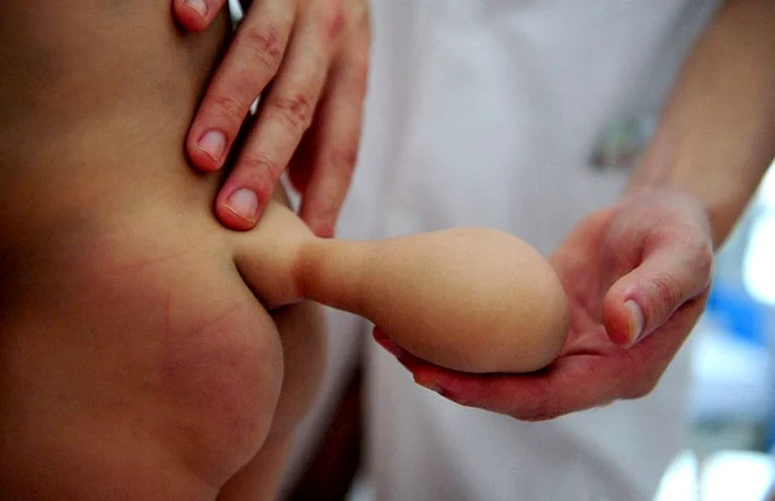 Mama lui Xiao Wei trebuie să mai aştepte până când copilul ei va scăpa de coadă. (Foto: Caters)