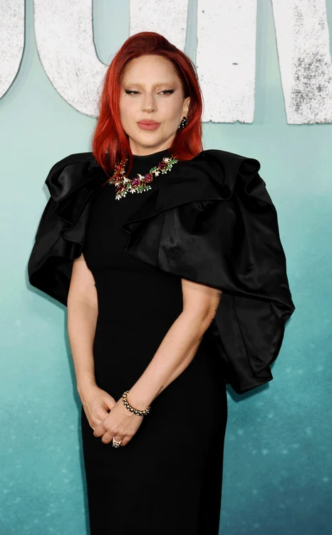 Așa arată Lady Gaga acum (Foto: Profimedia)