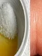 1 care sunt tratamentele naturale care te scapa de negi in cel mai scurt timp kcqr png png
