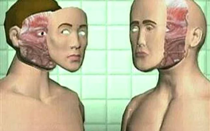 Craiova: EXCLUSIV / Medicul care a iniţiat în premieră mondială primul transplant facial de la un cadavru vine în Bănie