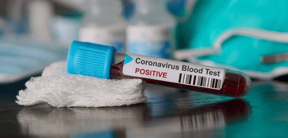 Judeţele care au înregistrat, miercuri, cele mai multe infectări cu SARS-CoV-2