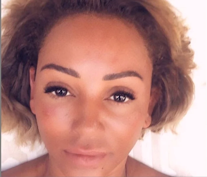 
    Mel B este internată în spitalFoto: Instagram  