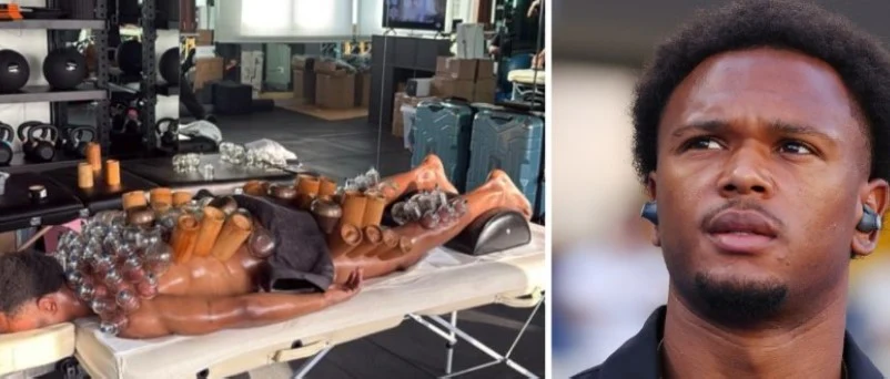 Imagine înfricoșătoare: un fotbalist belgian și-a umplut spatele cu ventuze. Ce este cuppingul