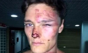 Rănile lui Alex au fost serioase jpeg