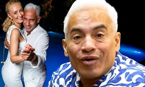 Wilmark, schimbare radicală! Celebrul coregraf a apelat pentru prima dată la medicul estetician!