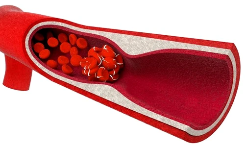 1 shutterstock 376055884 jpg jpeg