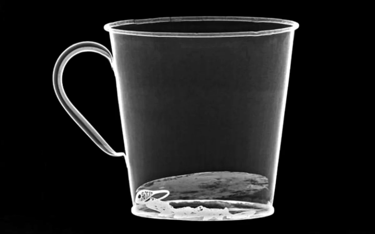  auschwitz xray large transeo i u9apj8ruoebjoaht0k9u7hhrjvuo zlengruma jpg jpeg