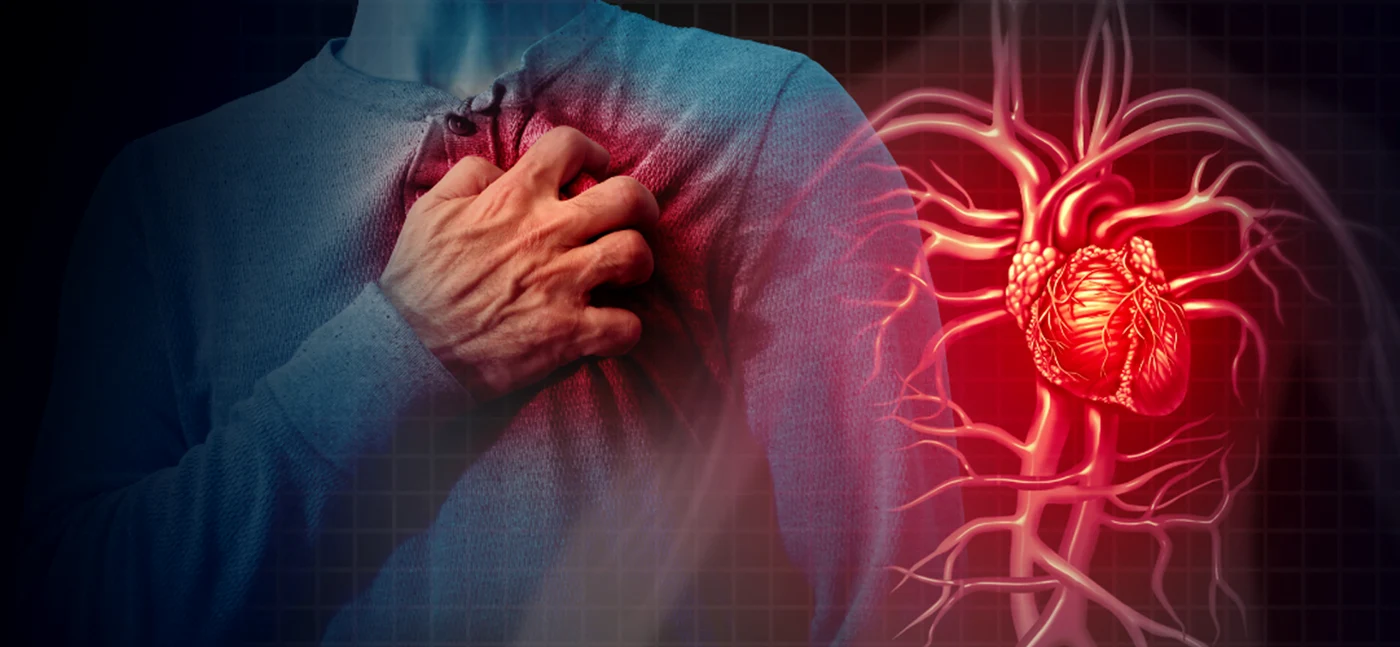 O persoană din trei riscă să facă infarc miocardic sau AVC FOTO: Arhivă