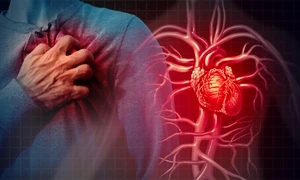 Atac de cord infarct miocardic Foto Heart Research UK png