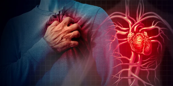 Atac de cord infarct miocardic Foto Heart Research UK png