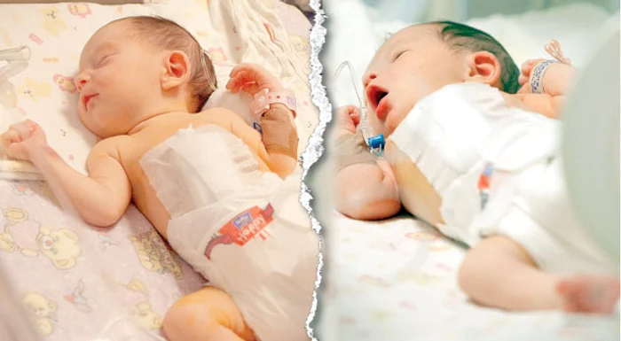 
    Elena are 2,6 kg, iar Maria are 3,3 kgFoto: Eduard Enea  