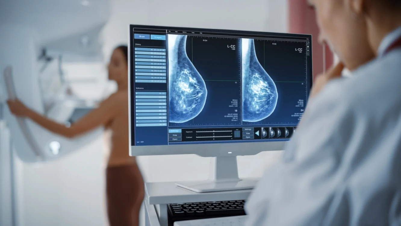 Screening și prevenție pentru cancerul de sân Foto Shutterstock