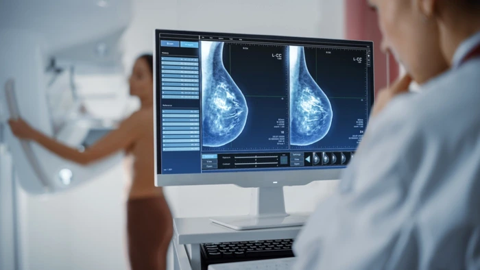 Mamografia este indicată pentru femeile peste 40 de ani Foto: Shutterstock 
