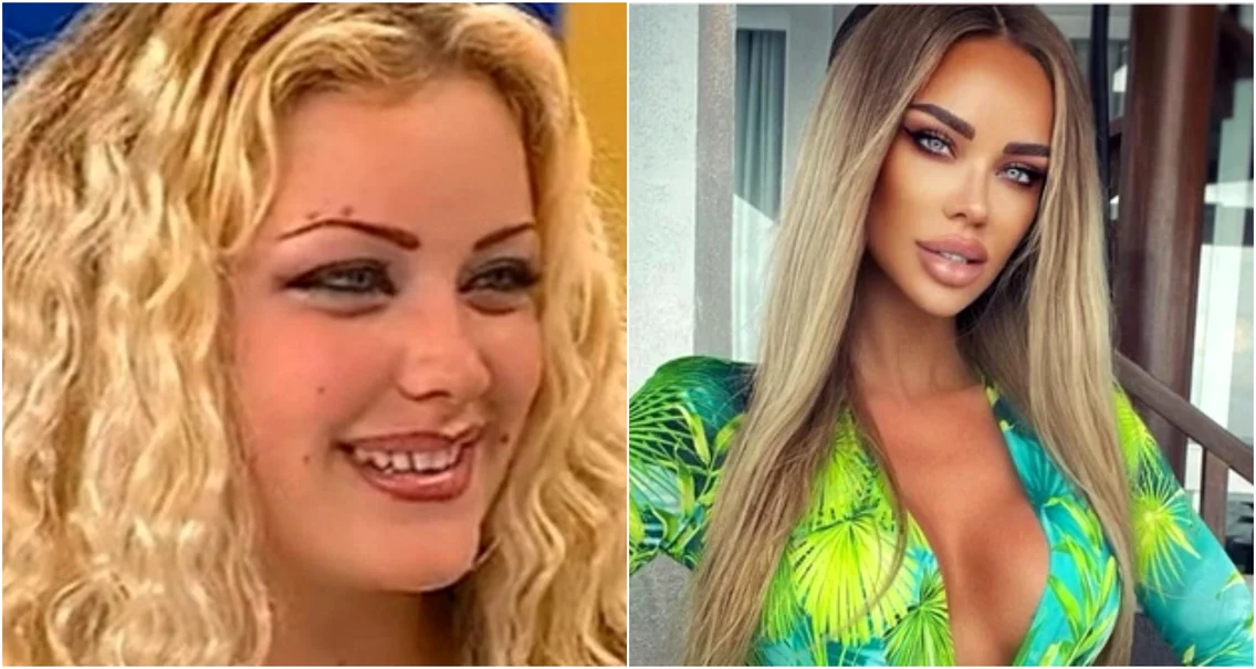 bianca dragusanu operatii estetice jpg