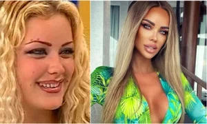 bianca dragusanu operatii estetice jpg