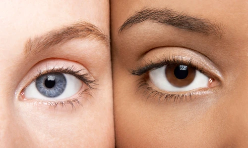 boli in functie de culoarea ochilor jpg