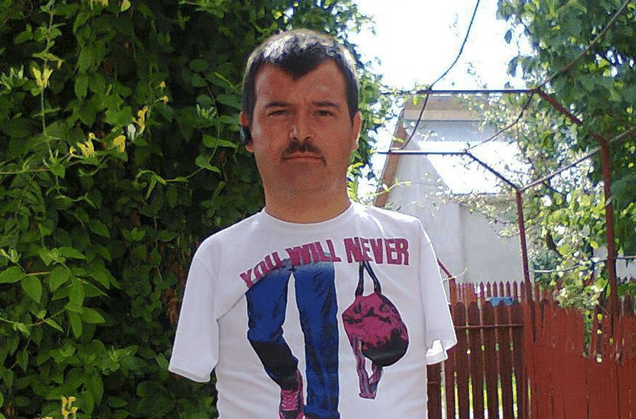 Marian, bărbatul care și-a pierdut braţele când era adolescent, primește o nouă lovitură