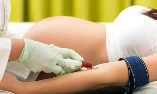 1 ce sunt analizele torch jpg jpeg