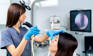 endoscopie nazala jpg