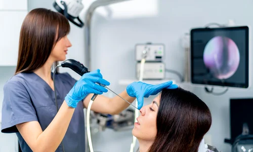 endoscopie nazala jpg