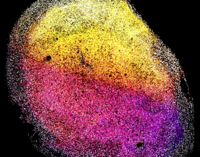O imagine a unui organoid de creier fetal uman întreg FOTO: Centrul Prințesa Máxima