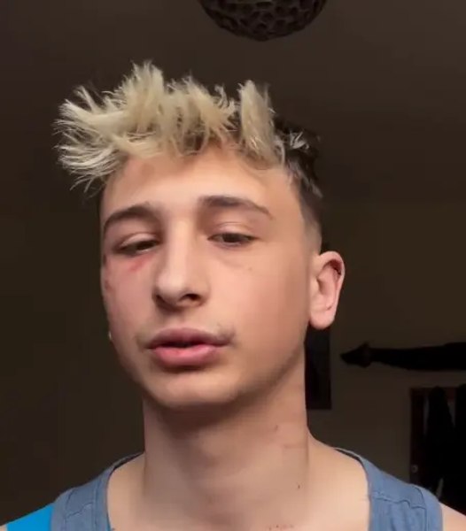Un cunoscut influencer român din Italia, snopit în bătaie pentru că este prea popular pe rețelele sociale VIDEO