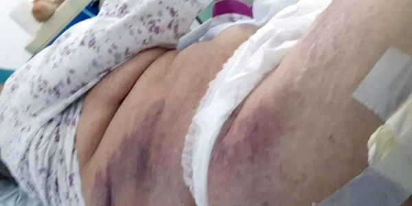 pacienta spital targu jiu 