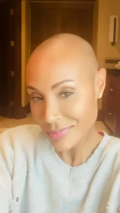 Jada le-a povestit fanilor că de doi ani se luptă cu alopecia - foto Instagram