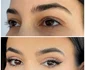 Blefaroplastie superioara realizata de Dr. Alina Mȋtcan Sursa foto Dr. Alina Mȋtcan