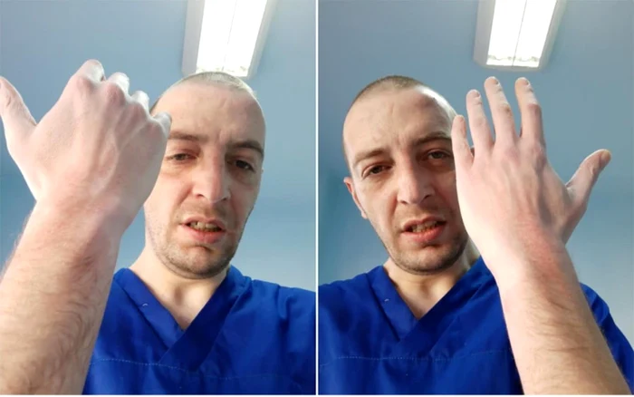 Medicul Alexandru Sava arată în ce fel i-au afectat pielea substanţele dezinfectante Imagine: Facebook