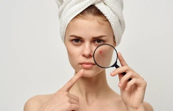 Cum construiești o rutină minimalistă pentru tenul mixt sau acneic fără să i distrugi bariera cutanată(1) jpg