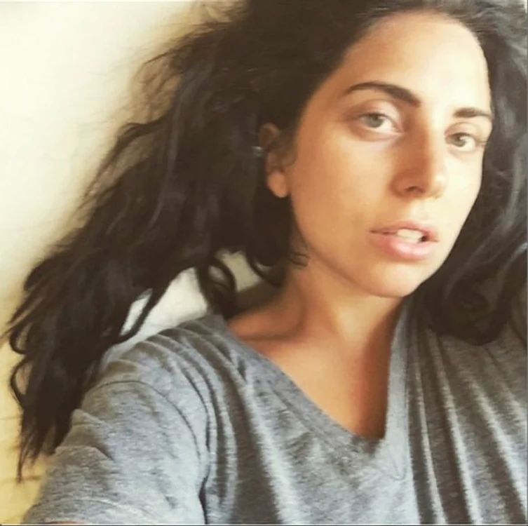 Lady Gaga are cearcăne adânci şi pare extrem de obosită, atunci când nu este machiată.