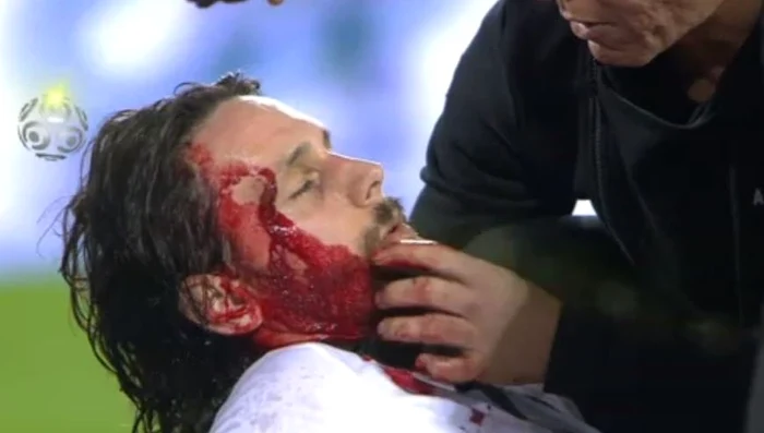 Steven Subotic, cu faţa plină de sânge