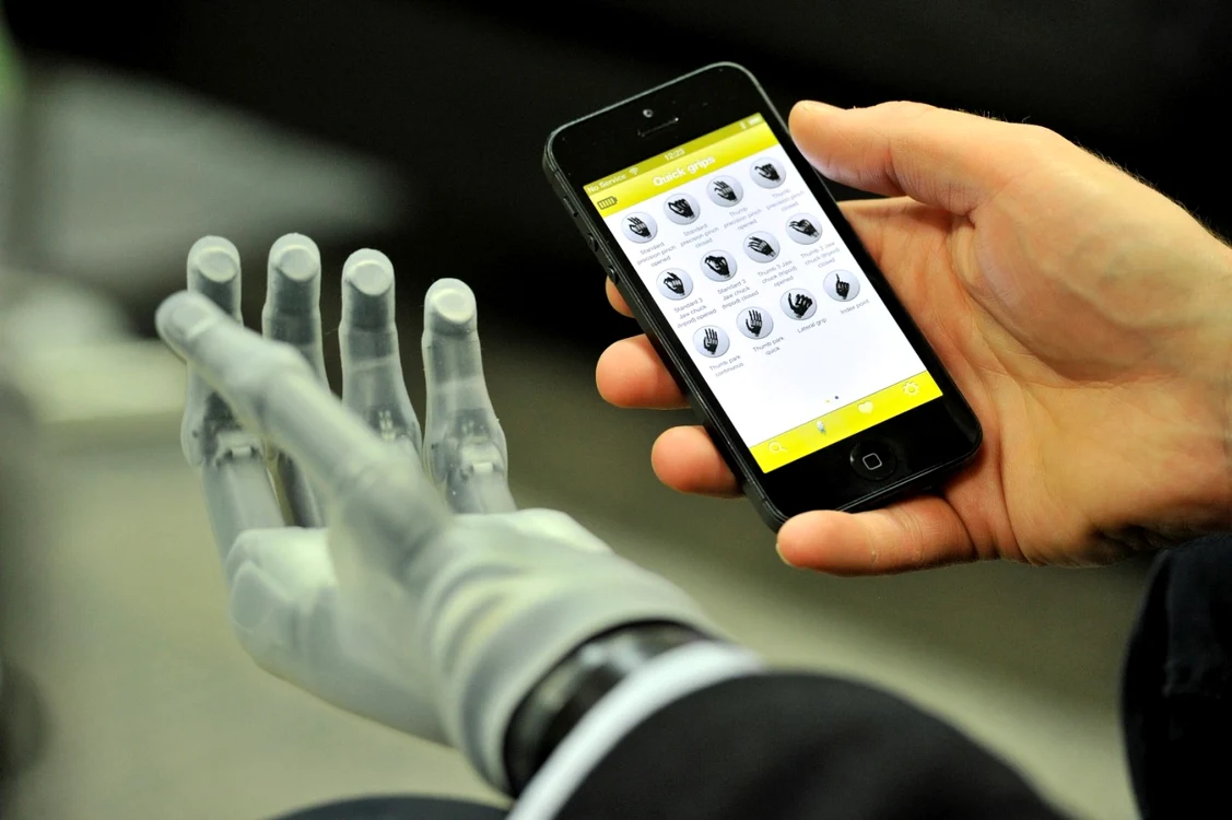 Mâna bionică poate fi controlată printr-un iPhone. FOTO Touch Bionics