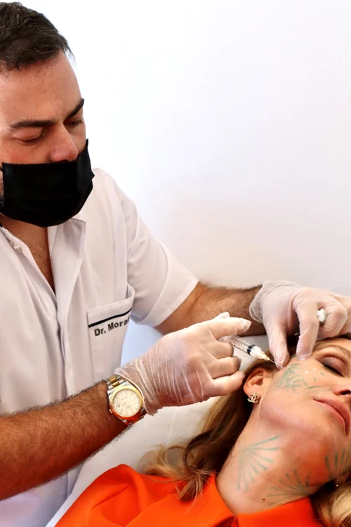 Carmen Negoiță a trecut printr-o procedură estetică pentru a-și rejuvena fața