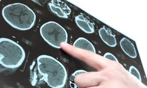 Stimulare artificiala creier Twitter jpg