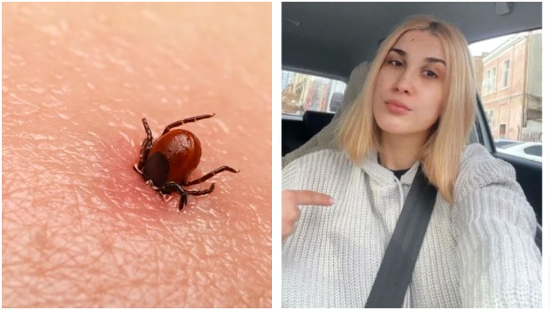 Adda suferă de borelioză, o boală cauzată de patogenii transmiși de o specie de căpușă