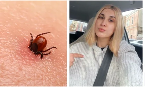 adda borelioza jpg