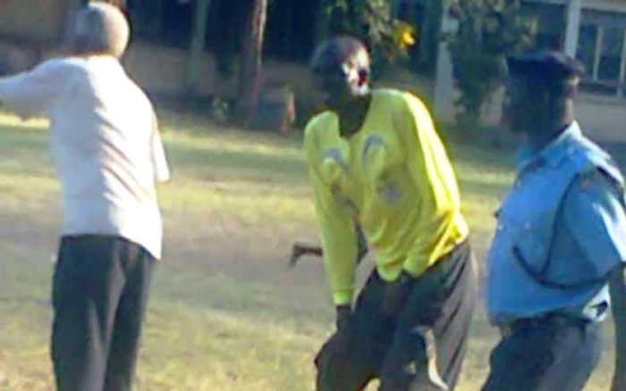 Centralul Martin Wekesa Wamalwa a fost agresat în septembrie pe terenul de joc, de către antrenorul unei echipe kenyene. Foto: www.whoateallthepies.tv