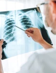 radiografie toracica jpg