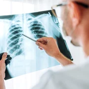 radiografie toracica jpg