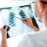 radiografie toracica jpg