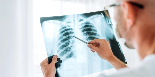 radiografie toracica jpg
