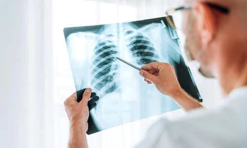 radiografie toracica jpg