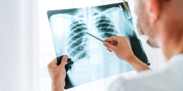 radiografie toracica jpg