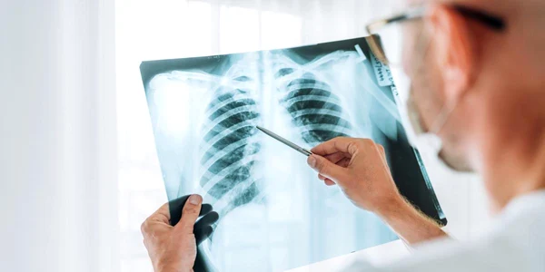 radiografie toracica jpg